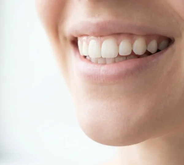 Gros plan d'un sourire naturel et éclatant avec des dents blanches parfaitement alignées, sur fond blanc, symbolisant le résultat de la chirurgie esthétique dentaire moderne